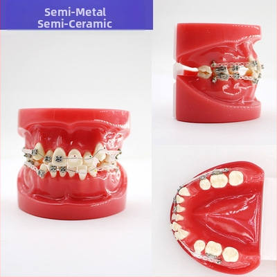 Μοντέλο διδασκαλίας οδοντιατρικής με παθολογική αποκατάσταση και τυπικό καλούπι εμφυτευμάτων — εγχώριο εμπορικό σήμα, με εκτυπωμένο λογότυπο, κατάλληλο για την οδοντιατρική εκπαίδευση