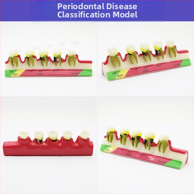Μοντέλο διδασκαλίας οδοντιατρικής με παθολογική αποκατάσταση και τυπικό καλούπι εμφυτευμάτων — εγχώριο εμπορικό σήμα, με εκτυπωμένο λογότυπο, κατάλληλο για την οδοντιατρική εκπαίδευση