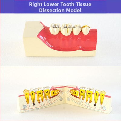 Μοντέλο διδασκαλίας οδοντιατρικής με παθολογική αποκατάσταση και τυπικό καλούπι εμφυτευμάτων — εγχώριο εμπορικό σήμα, με εκτυπωμένο λογότυπο, κατάλληλο για την οδοντιατρική εκπαίδευση