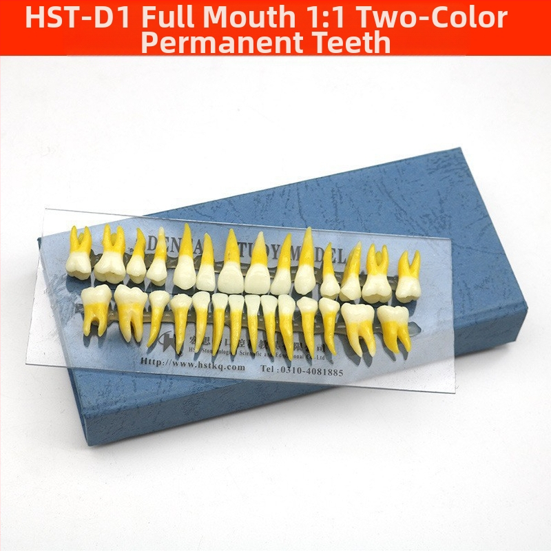 Μοντέλο διδασκαλίας οδοντιατρικής με παθολογική αποκατάσταση και τυπικό καλούπι εμφυτευμάτων — εγχώριο εμπορικό σήμα, με εκτυπωμένο λογότυπο, κατάλληλο για την οδοντιατρική εκπαίδευση