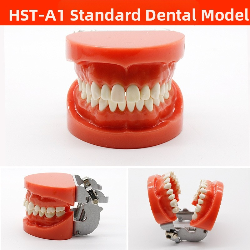 Μοντέλο διδασκαλίας οδοντιατρικής με παθολογική αποκατάσταση και τυπικό καλούπι εμφυτευμάτων — εγχώριο εμπορικό σήμα, με εκτυπωμένο λογότυπο, κατάλληλο για την οδοντιατρική εκπαίδευση