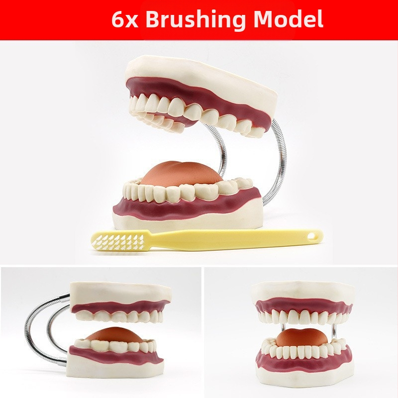 Μοντέλο διδασκαλίας οδοντιατρικής με παθολογική αποκατάσταση και τυπικό καλούπι εμφυτευμάτων — εγχώριο εμπορικό σήμα, με εκτυπωμένο λογότυπο, κατάλληλο για την οδοντιατρική εκπαίδευση