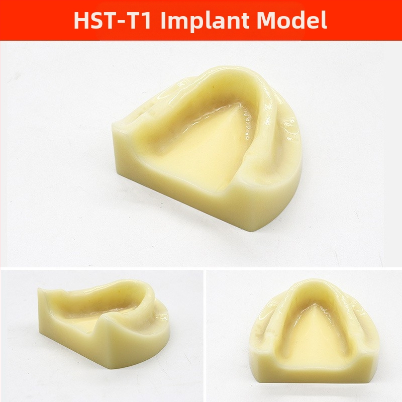 Μοντέλο διδασκαλίας οδοντιατρικής με παθολογική αποκατάσταση και τυπικό καλούπι εμφυτευμάτων — εγχώριο εμπορικό σήμα, με εκτυπωμένο λογότυπο, κατάλληλο για την οδοντιατρική εκπαίδευση