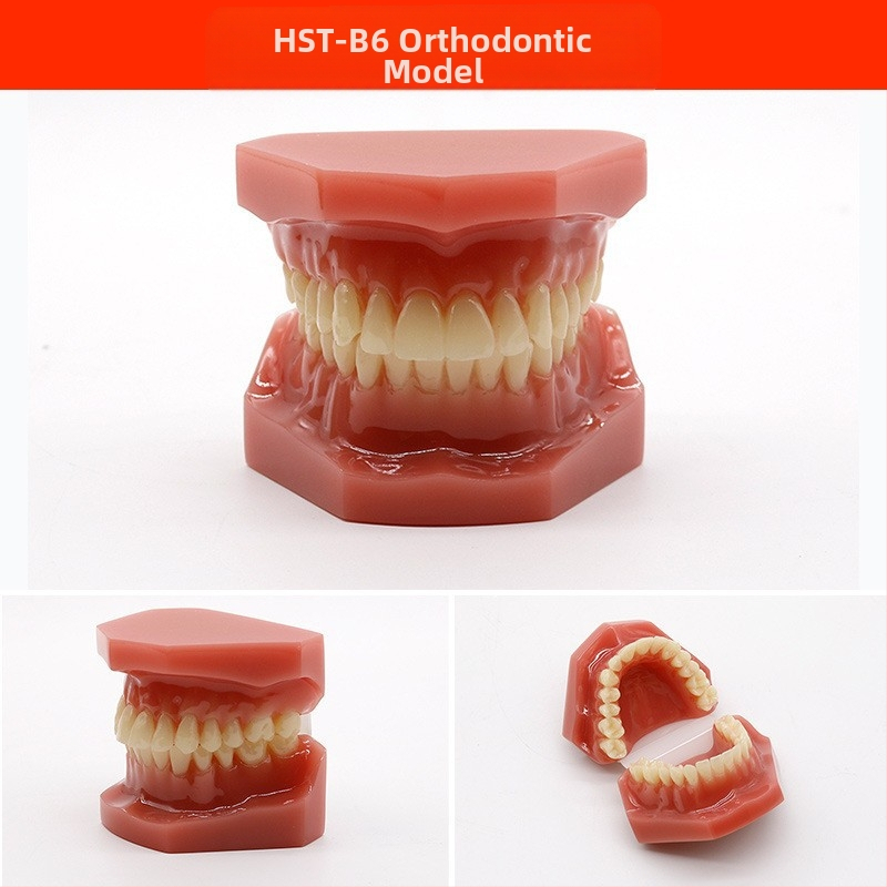 Μοντέλο διδασκαλίας οδοντιατρικής με παθολογική αποκατάσταση και τυπικό καλούπι εμφυτευμάτων — εγχώριο εμπορικό σήμα, με εκτυπωμένο λογότυπο, κατάλληλο για την οδοντιατρική εκπαίδευση