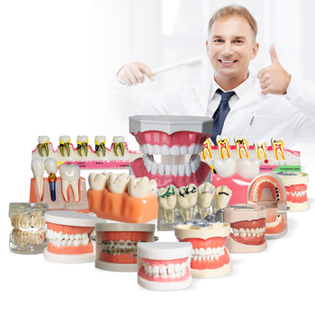 Fogászati oktató fogmodell, levehető fogpótlás, ABS gyanta, felnőtteknek, 180 g