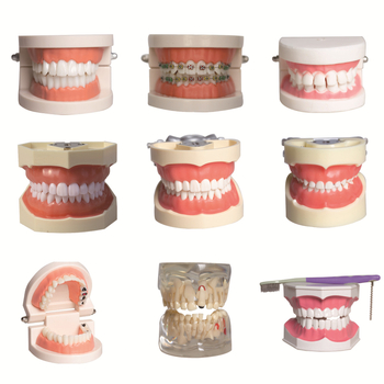 Fogászati oktató fogmodell, levehető fogpótlás, ABS gyanta, felnőtteknek, 180 g