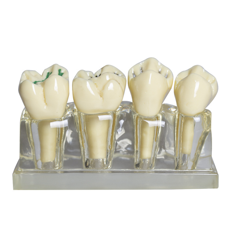 Fogászati oktató fogmodell, levehető fogpótlás, ABS gyanta, felnőtteknek, 180 g