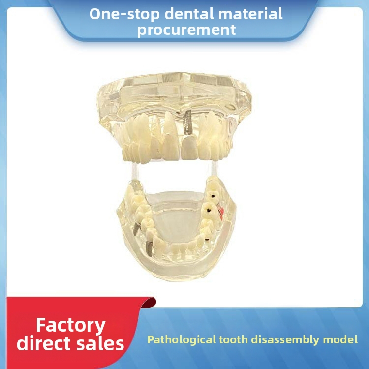 Fogászati oktató fogmodell, levehető fogpótlás, ABS gyanta, felnőtteknek, 180 g