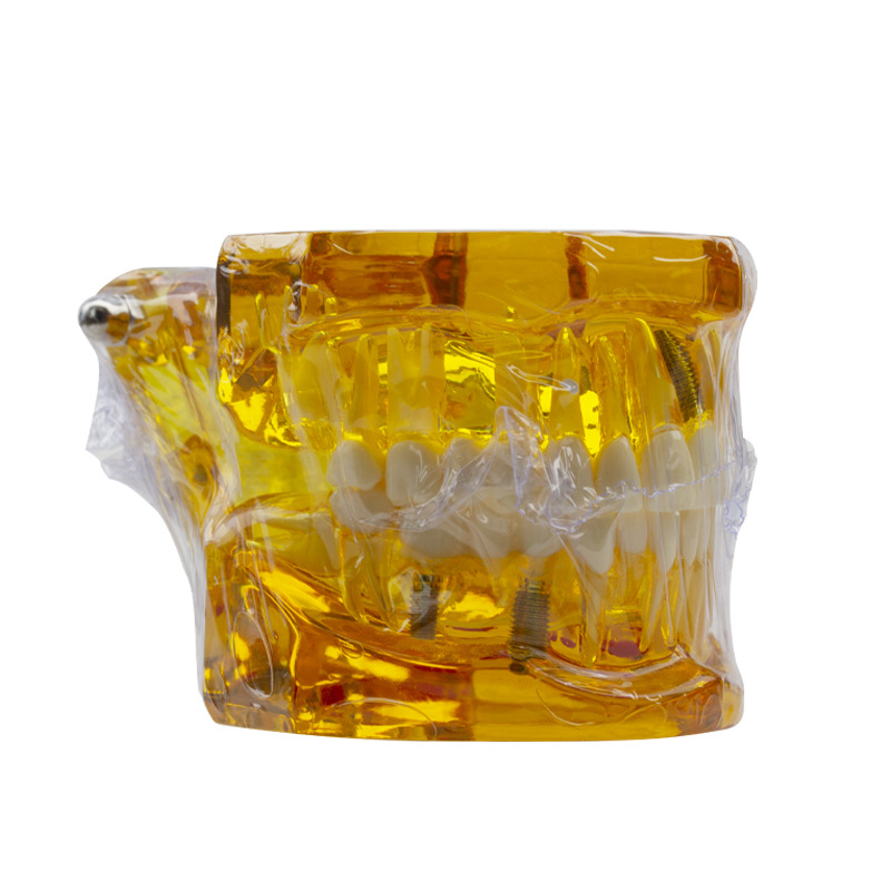 Fogászati oktató fogmodell, levehető fogpótlás, ABS gyanta, felnőtteknek, 180 g