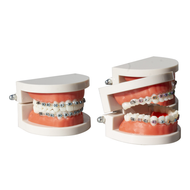 Ortodontikus fém bracket modell bemutatóhoz, felnőtteknek, 140 g, dobozban 100 darab, helyi márka