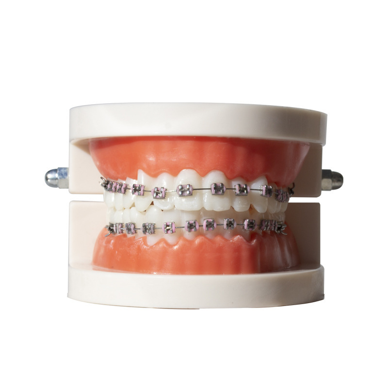 Ortodontikus fém bracket modell bemutatóhoz, felnőtteknek, 140 g, dobozban 100 darab, helyi márka