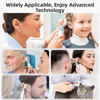 Χειροκίνητο ενδοσκόπιο αυτιού και λάρυγγα με οθόνη HD – οπτικό ωτοσκόπιο με WiFi και Glow ακροφύσιο για αυτί