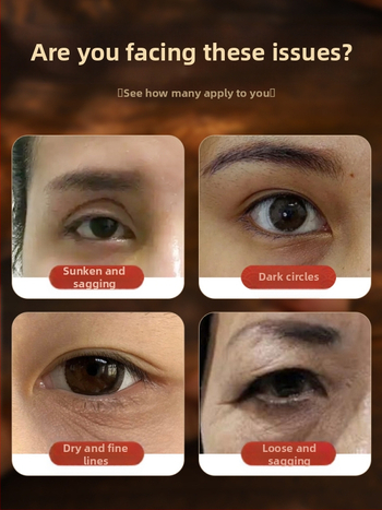 Bronzinė ilga akupunktūrinė lazdelė kojų masažui – akupresūros įrankis su meridianų žemėlapiu ir apsauginiu gaubtuvu