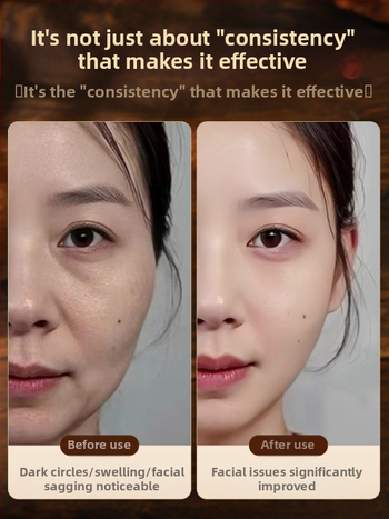 Bronzinė ilga akupunktūrinė lazdelė kojų masažui – akupresūros įrankis su meridianų žemėlapiu ir apsauginiu gaubtuvu