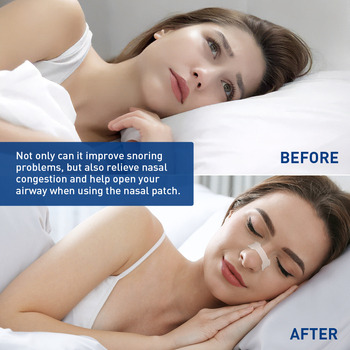 Ρινικές λωρίδες κατά του ροχαλητού με ενισχυμένη κόλλα, υλικό PVC, απλό στυλ, προσαρμογή επεξεργασίας, μέθοδος προσαρμογής