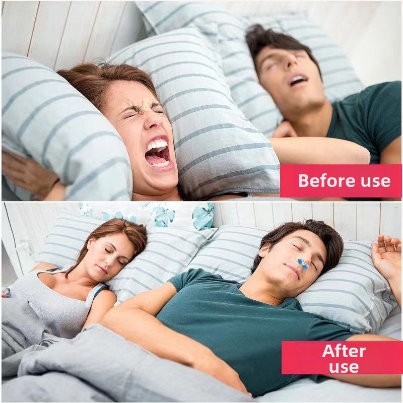 Silikona deguna klipsa pret snorēšanu, minimālistisks dizains, izcelsme: Ķīna