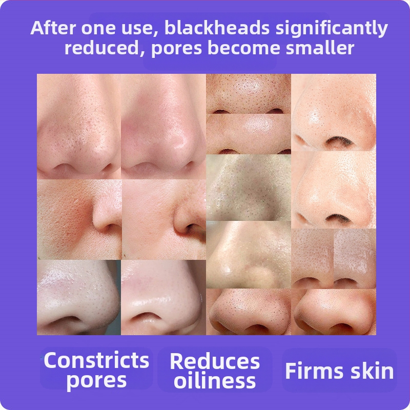 Визуално премахване на черни точки — ултразвуков ръчен уред, модел ZM613, ABS корпус, 3 степени на настройка