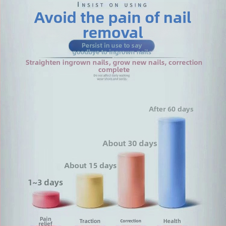 Nagų įdaužos žnyplių rinkinys – nerūdijančio plieno, koregavimas įaugusiam nagui