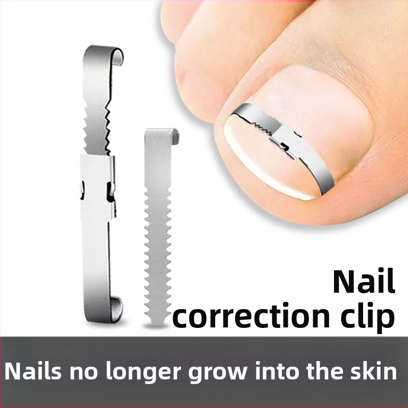 Nagų įdaužos žnyplių rinkinys – nerūdijančio plieno, koregavimas įaugusiam nagui