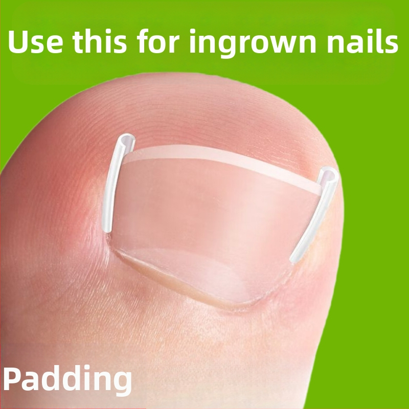 Μίνι πλαστικό υπόθεμα διόρθωσης για το νύχι του μεγάλου δακτύλου, φορητό και σκίζεται