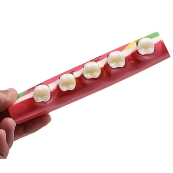 Model dentar parodontal – demonstrație a evoluției cariilor și a clasificării afecțiunilor parodontale; material: rășină; ambalare: 100 buc.; Barcode: 456789