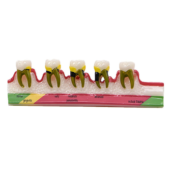 Model dentar parodontal – demonstrație a evoluției cariilor și a clasificării afecțiunilor parodontale; material: rășină; ambalare: 100 buc.; Barcode: 456789