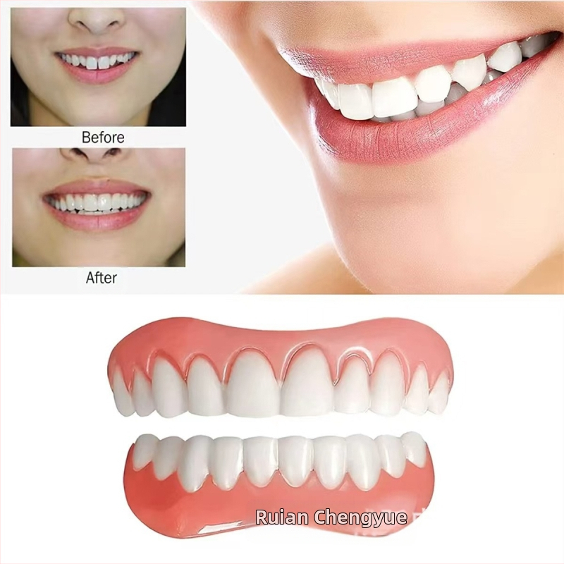 Protēžu komplekts – augšējā un apakšējā pilns komplekts, tūlītējs smaids, balināšana, reālistiski zobi