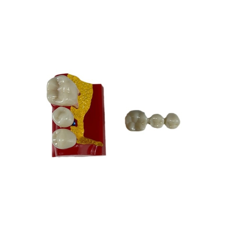 Dantų mokymo modelis studentų praktikai su implantavimo smeigių demonstravimu, dervos medžiaga, prekinis ženklas Liyue; palaiko privačias prekes