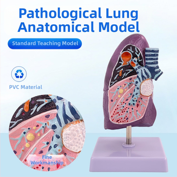 Blue Butterfly пластмасов модел на вътрешни органи: човешка трахея и белите дробове - анатомия и патология с разрез на пушач.