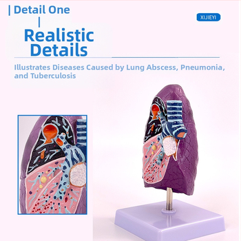 Blue Butterfly пластмасов модел на вътрешни органи: човешка трахея и белите дробове - анатомия и патология с разрез на пушач.