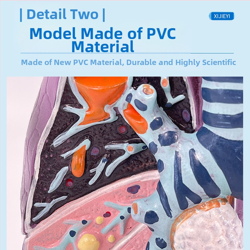 Blue Butterfly пластмасов модел на вътрешни органи: човешка трахея и белите дробове - анатомия и патология с разрез на пушач.