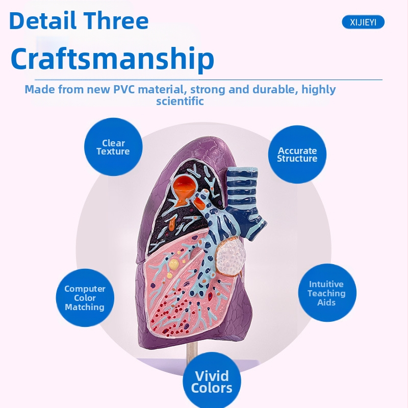 Blue Butterfly пластмасов модел на вътрешни органи: човешка трахея и белите дробове - анатомия и патология с разрез на пушач.