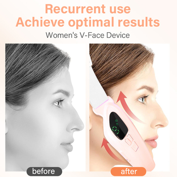 HY73 Ηλεκτρική συσκευή V‑προσώπου με μικρορεύμα, 6 λειτουργίες LED φωτισμού, φορητός επαναφορτιζόμενος μασάζ προσώπου