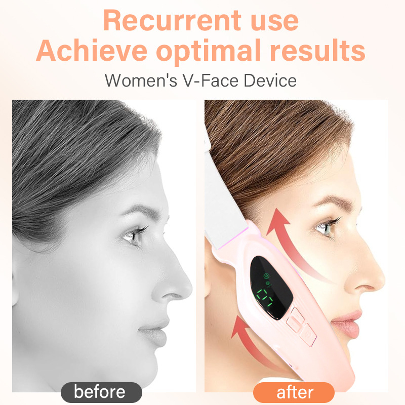 HY73 Електрическо V‑лицево устройство за микроток, шест светлинни режима, портативен презареждащ се масажор за лице