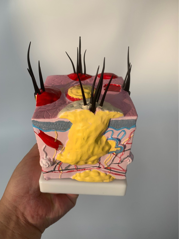 Μοντέλο δέρματος σκύλου με τρίχωμα, παθήσεις από δαγκώματα ψύλλων και ανατομία δέρματος με καρδιά