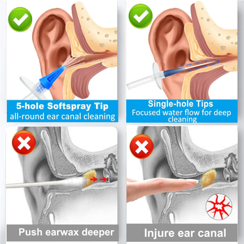 Σετ καθαρισμού αυτιού, ABS+PC υλικό, μάρκα Shengbaojini, μοντέλο W10, μη εισαγόμενο