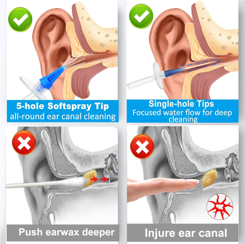 Σετ καθαρισμού αυτιού, ABS+PC υλικό, μάρκα Shengbaojini, μοντέλο W10, μη εισαγόμενο