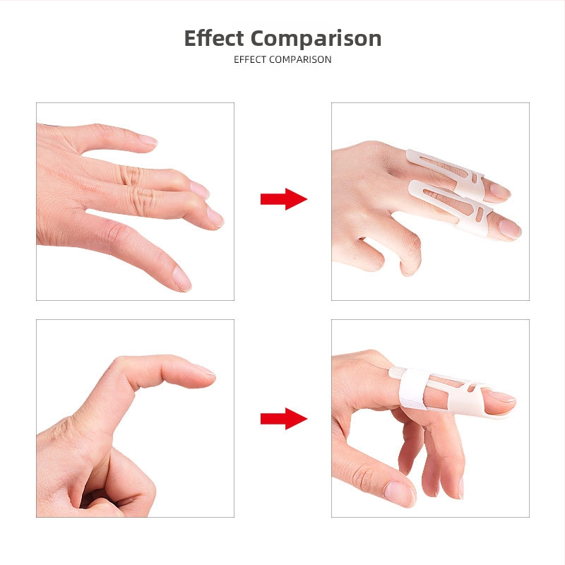 Шина за пръст с поддържаща сгъване на ставата — пластмасова защитна маншета за пръсти, за възрастни