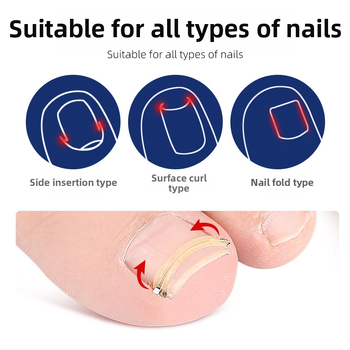 Δαχτύλι ποδιού για νύχια με μηχανισμό εφελκυστικής ανάκαμψης και κύλινδρο αυλακώσεων νυχιών; πλενόμενος και επαναχρησιμοποιήσιμος, 18 g