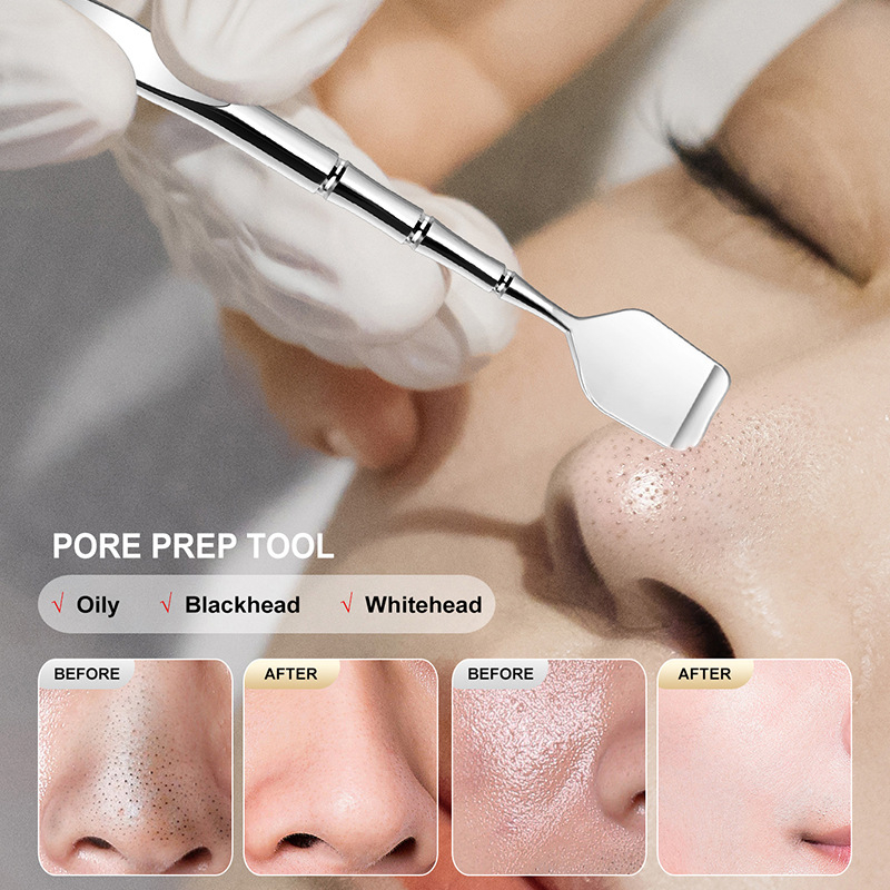 Juodųjų inkštirų valymo įrankis — nerūdijančio plieno; įtrauktas juodųjų inkštirų šepetėlis ir skrobas; svoris 33 g; pakuotė 500 vnt; prekinis ženklas Emperor light