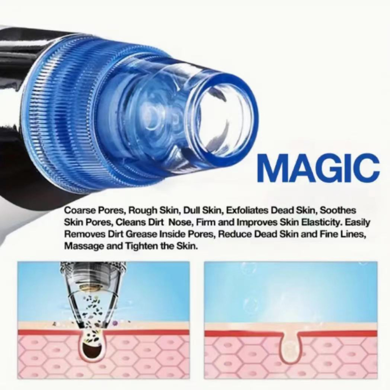 Ултразвуков инструмент за всмукване на черни точки, модел MY-032, функция: всмукване на черни точки, ABS корпус, CE-EMC