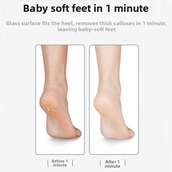 Γυαλιστήρας ποδιών με λείθο πομφόλιου για αφαίρεση νεκρού δέρματος και κάλων στη φτέρνα – Jie Rabbit Line