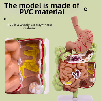 Модел на човешки стомах за анатомия — коронален разрез, патологичен модел със перфорация, обучение по гастроентерология