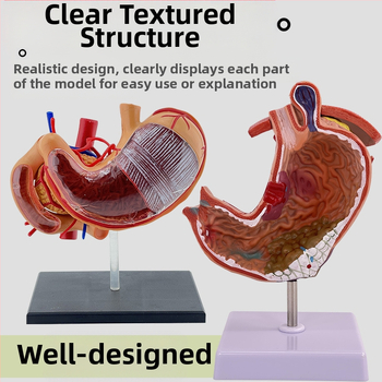 Модел на човешки стомах за анатомия — коронален разрез, патологичен модел със перфорация, обучение по гастроентерология
