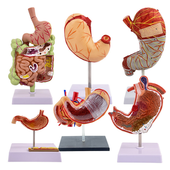 Модел на човешки стомах за анатомия — коронален разрез, патологичен модел със перфорация, обучение по гастроентерология