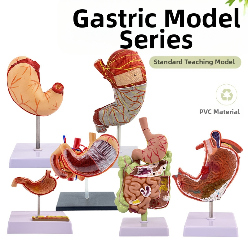 Модел на човешки стомах за анатомия — коронален разрез, патологичен модел със перфорация, обучение по гастроентерология