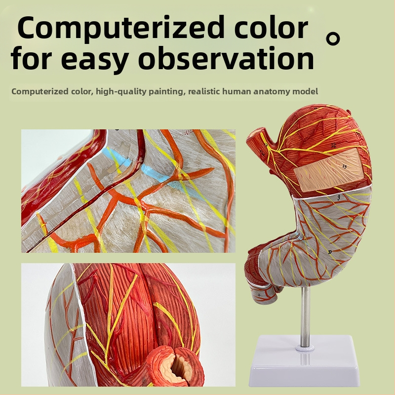 Модел на човешки стомах за анатомия — коронален разрез, патологичен модел със перфорация, обучение по гастроентерология