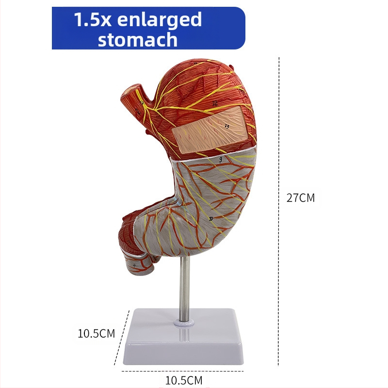 Модел на човешки стомах за анатомия — коронален разрез, патологичен модел със перфорация, обучение по гастроентерология