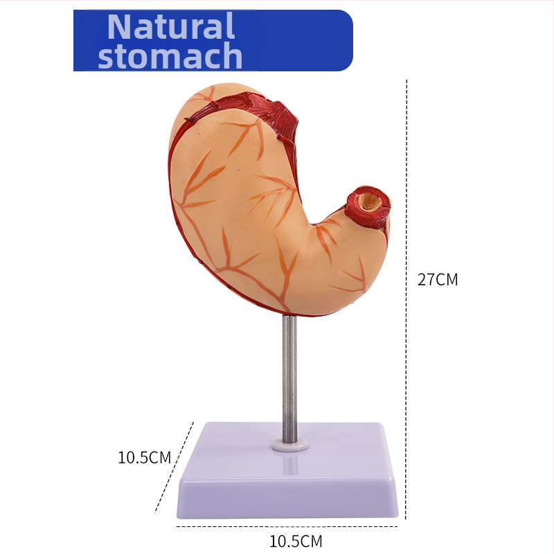 Модел на човешки стомах за анатомия — коронален разрез, патологичен модел със перфорация, обучение по гастроентерология