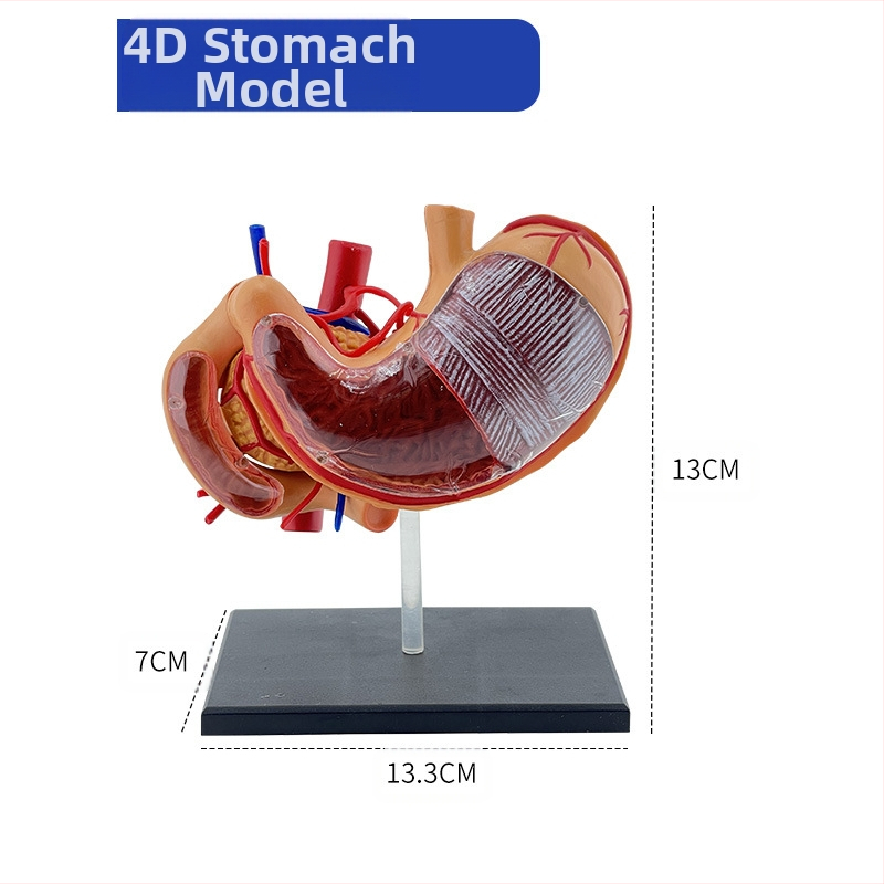 Модел на човешки стомах за анатомия — коронален разрез, патологичен модел със перфорация, обучение по гастроентерология